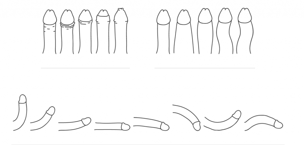 forme e dimensioni del pene